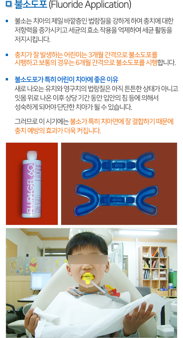 소아치과 설명 03