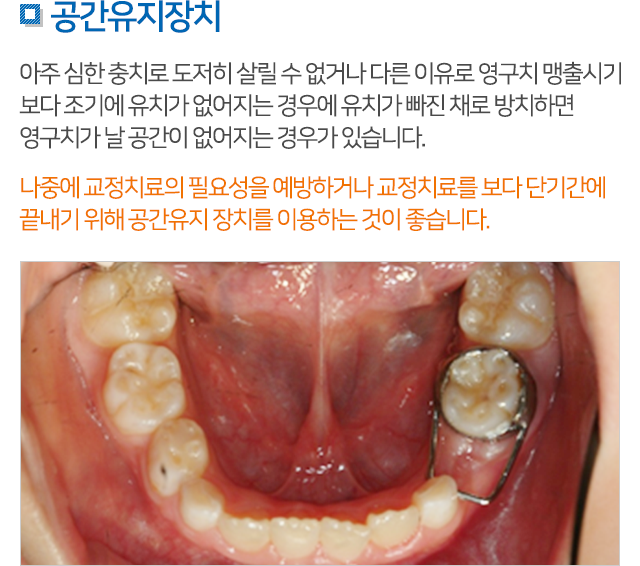 소아치과 설명 05