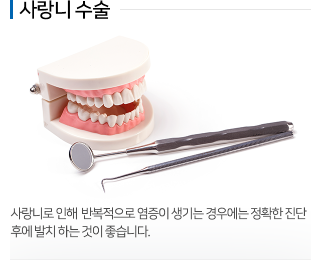 사랑니발치 설명 01